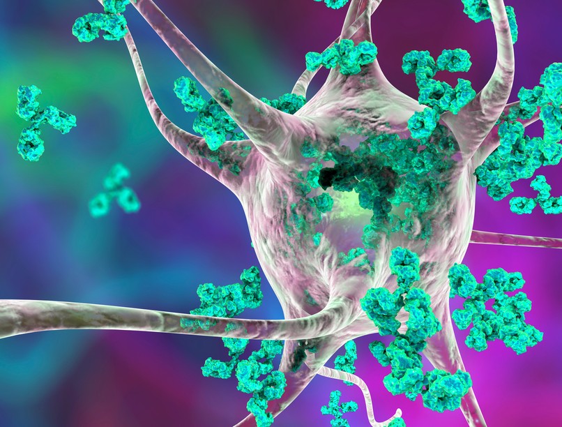 Guillain-Barré szindróma, Putyin, tanácsadó, betegség