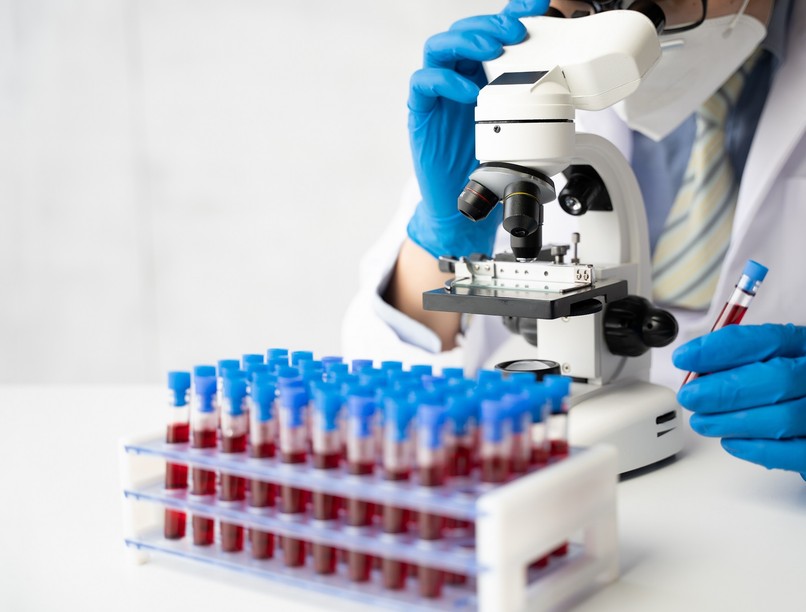 kóros trombocita szám  ok betegség hematológia vérkép