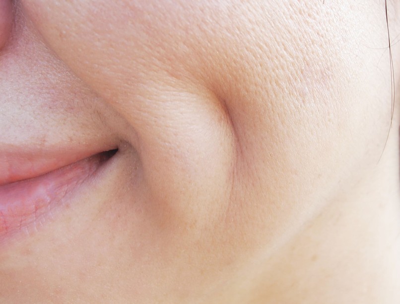 mit jelentenek a gödröcskék az arcon