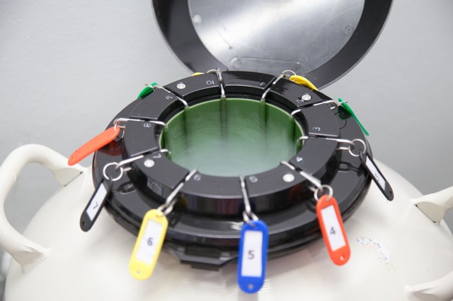 Mínusz 196 Celsius-fokos remény: új eljárás segíti a rákbeteg gyerekek későbbi gyermekvállalását