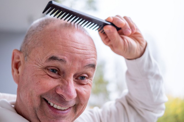 Komoly áttörést ígér a kopaszodás elleni küzdelemben egy új szer