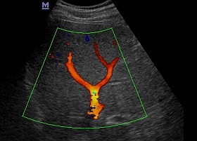 Visszér-vagy szívpanaszokkal küzd? Tudjon meg többet állapotáról Doppler vizsgálattal