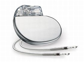 Teljes élet - pacemakerrel is!