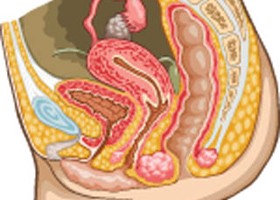 A vulva rák a nő külső nemi szerveinek, a szeméremtestnek a rákos megbetegedése. Leggyakrabban a vulva intraepiteliális neoplázia (VIN) nevű állapot előzi meg, ami egy rákmegelőző állapot. A vulva rák korai felismerése és kezelése fontos a gyógyulás szempontjából, ezért a rendszeres nőgyógyászati szűrés és a gyanús tünetek (viszketés, vérzés, csomó, elváltozás a bőrön) mielőbbi orvosi kivizsgálása javasolt. 