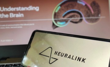 Agyi chip emberbe - még az idén beültetnék 