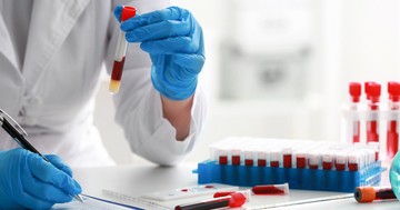  Mi minden derülhet ki a vérből? A vérvizsgálat akkor is hasznos, ha mindent rendben hiszünk 