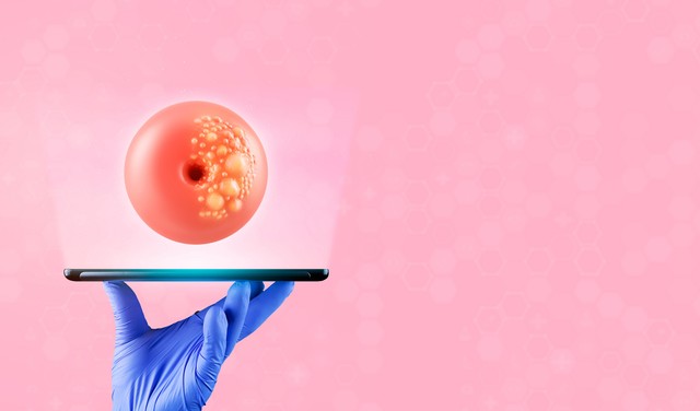 Milyen gyorsan fejlődik ki a méhnyakrák? Ezek a korai stádium tünetei