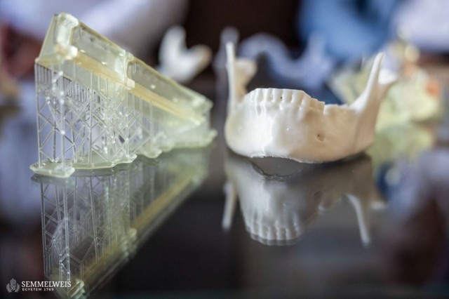 Már háromdimenziós tervezéssel is végeznek műtéteket