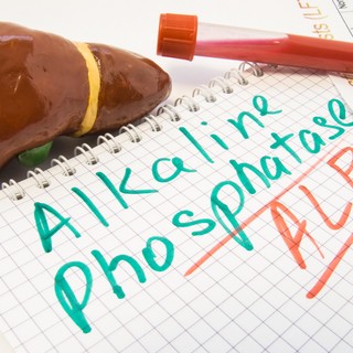 Mit jelent az ALP érték a laborleleten? című cikk nyitóképe