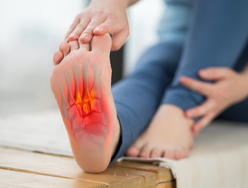 lúdtalp, kezelés, derékfájás, hátfájás