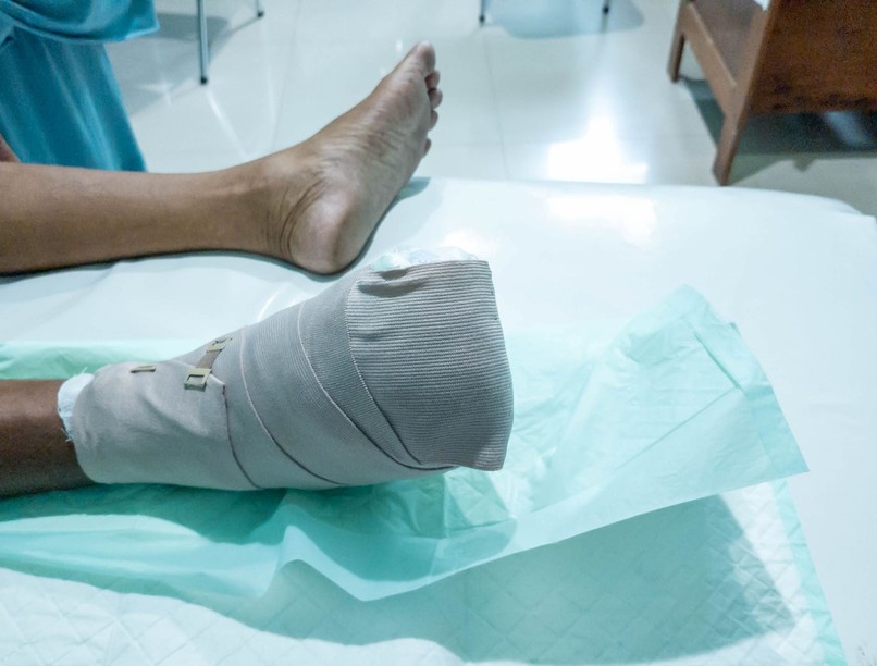 Bürger-kór tünet vizsgálat kezelés