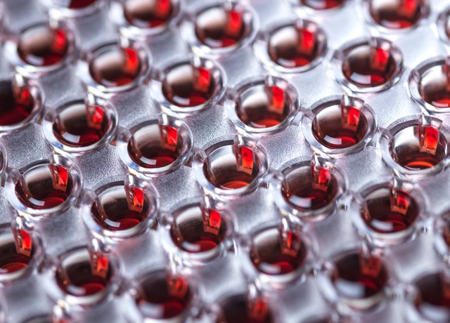 Vérteszt: még az első ráktünetek előtt 50-féle tumort mutathat ki