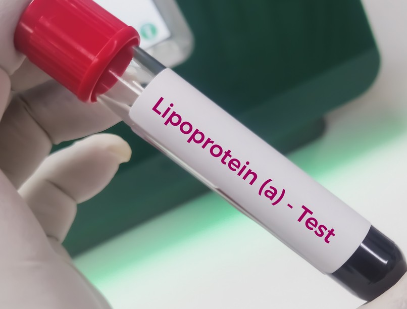 ldl-koleszterin, lipoprotein örökletes kezelés