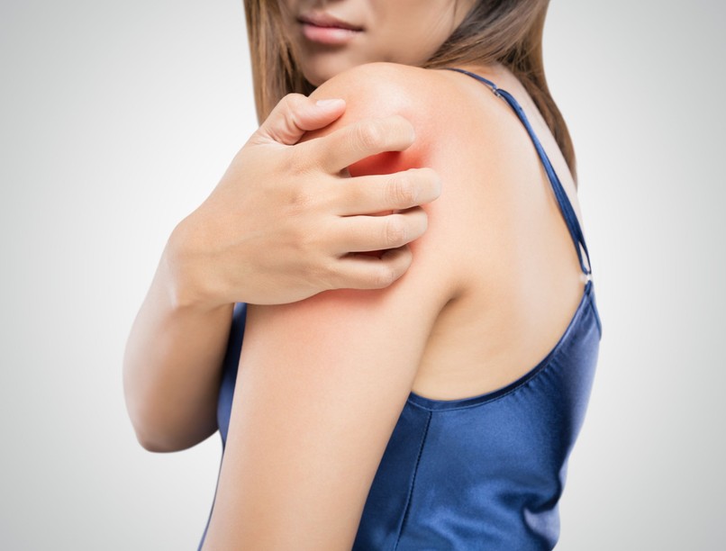 pikkelysömör, száraz bőr, viszketés, kezelés