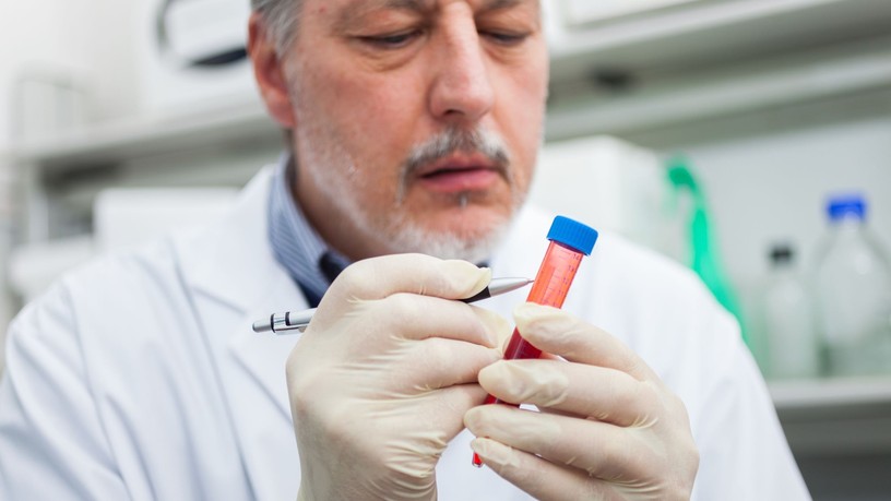 Parkinson-kór legkorábbi jele vérből