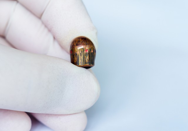 Mit tesz a lövés a testtel és túlélhető-e, ha eltalálnak?