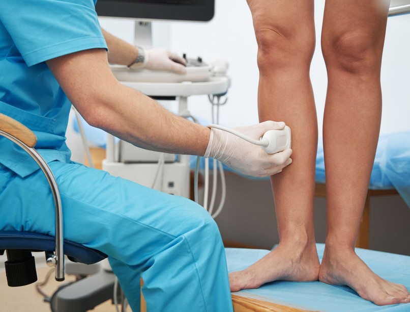 trombózis vérrög, trombocita, tünet