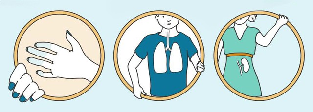 Hogyan lehet együtt élni a szisztémás sclerosis-szal?