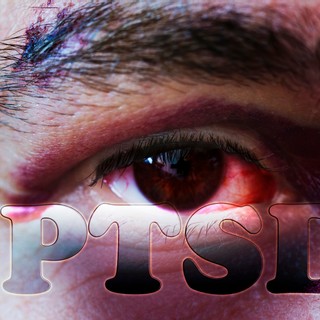 Poszttraumás stressz zavar (PTSD) tünetei, vizsgálata és kezelése című cikk nyitóképe