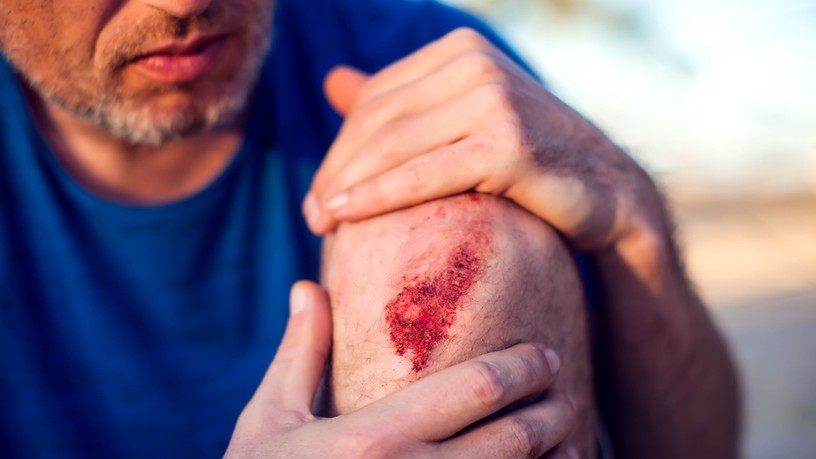 Vágások, horzsolás tünet vizsgálat kezelés