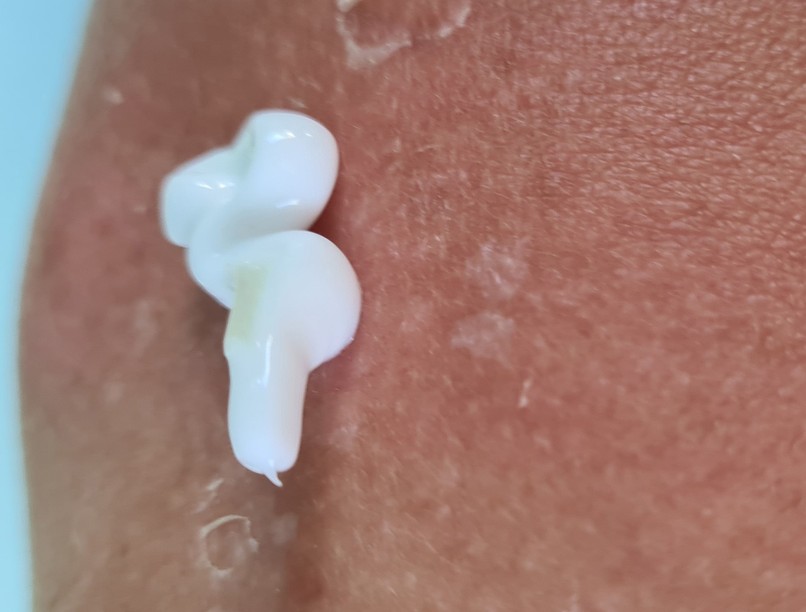 gyenge immunrendszer gomba bőrgomba fertőzés