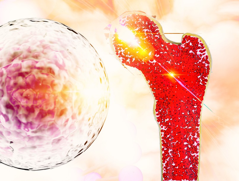 csontrák, rák, daganat, tünetei