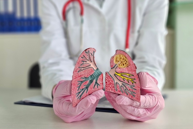 Hörghurut tünetei, vizsgálata és kezelése