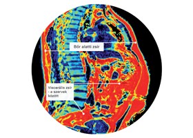 Ami eltünteti a zsírt a vérből