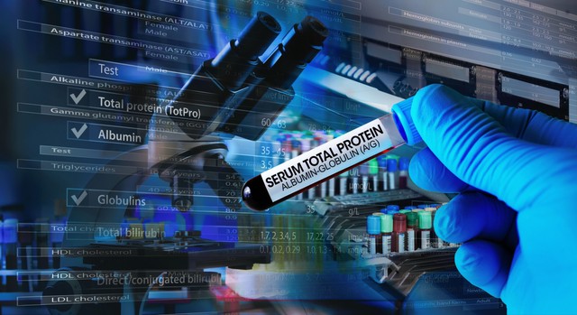 Ezt rontják el a legtöbben, amikor kivizsgáltatják magukat lisztérzékenységre