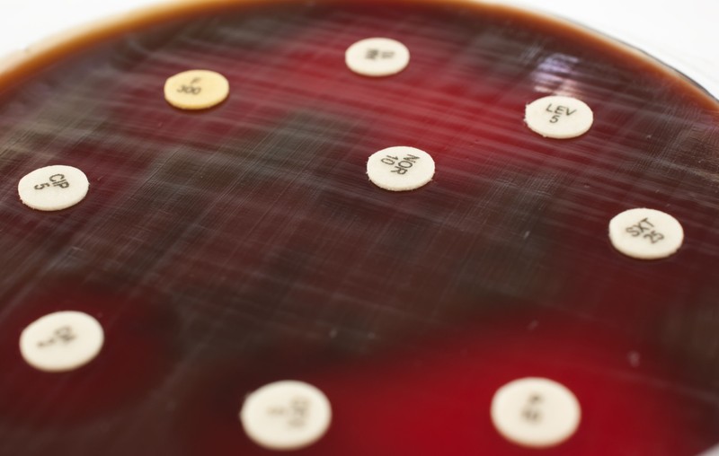 Egy betegséget jobb megelőzni, mint elszenvedni