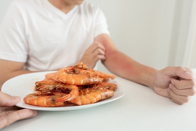 Ételallergia felnőttkorban: emiatt alakulhat ki később is című cikk nyitóképe