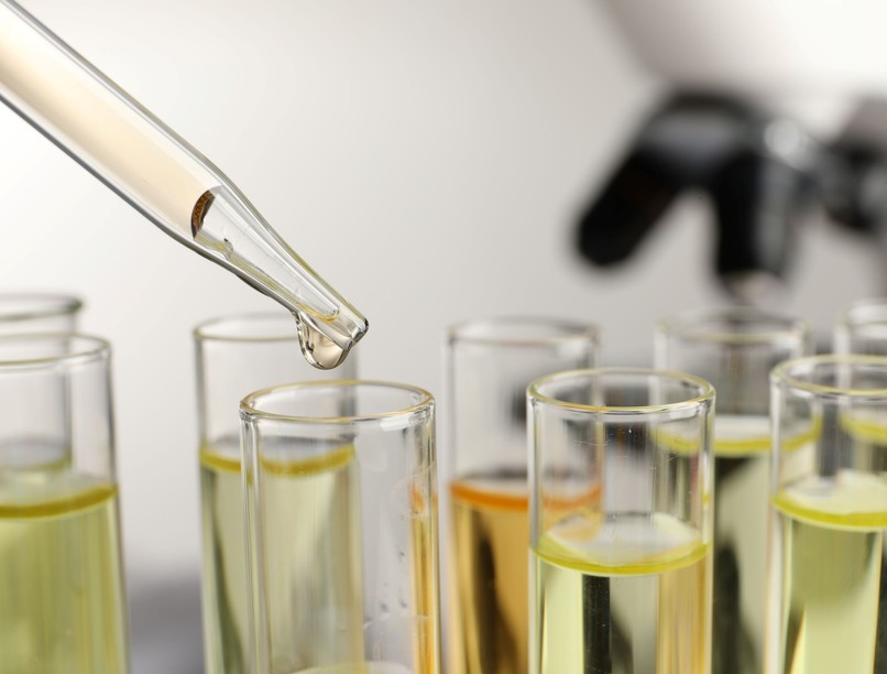 vizeletszín Átlátszó színtelen vizelet mit jelent