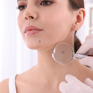 Bélbaktériumokkal meghatározható a bőrrák kockázata – de van egy bökkenő című cikk nyitóképe