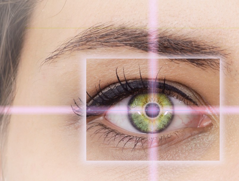 lézeres szemműtét