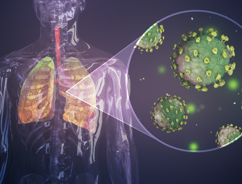 koronavírus, tüdő, covid-19, koronavírus ellenszer