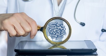  Mikrobiomtesztek: alkalmasak a diagnosztizálásra vagy sem? A szakértők tanácsa egyértelmű 