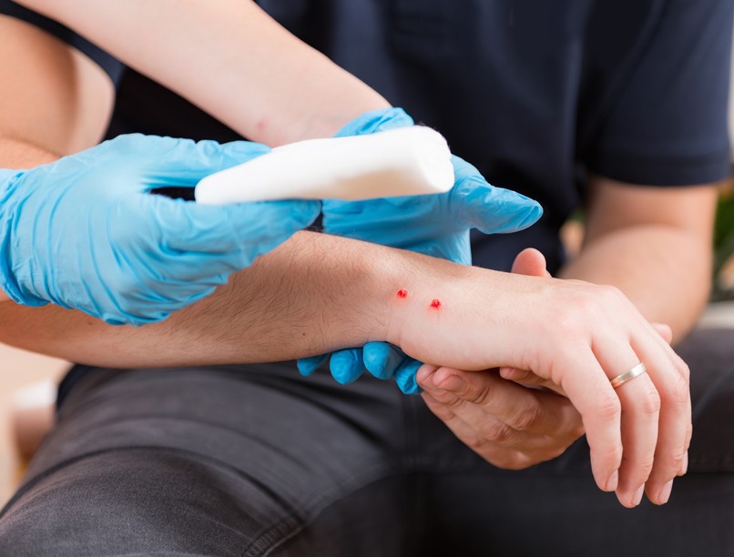 Kígyómarás mérgezés Kígyóharapás tünet vizsgálat kezelés