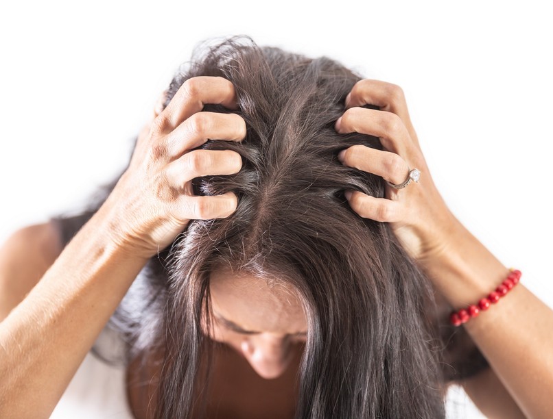 korpa viszketés fejbőr irritáció oka