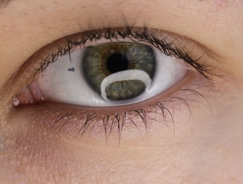 apró úszó folt, pötty szem oka, látótér