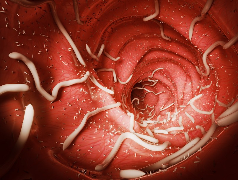 elősködő orsógiliszta orsóféreg jele bélfertőzés tünet