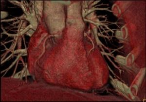 A Cardio-CT lényege
