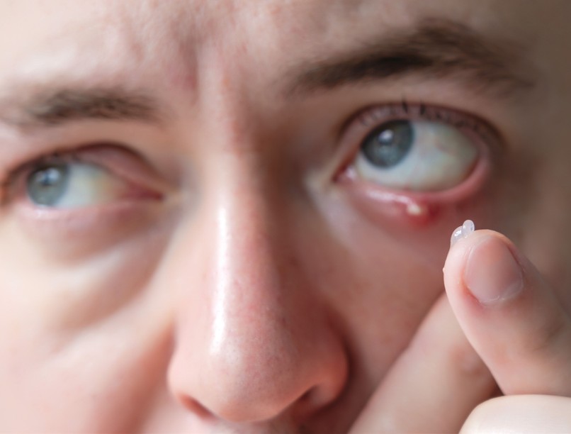 árpa, jégárpa, különbség, szem