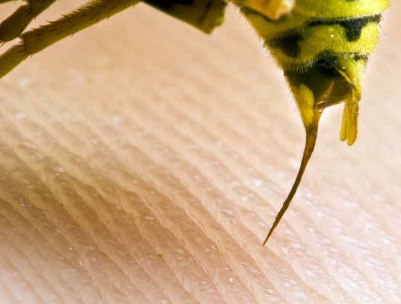 allergia darázscsípés után kalcium