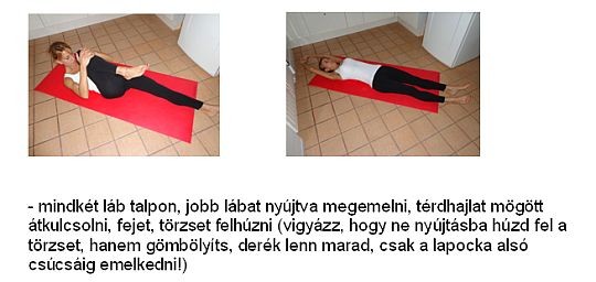 Gyógytorna derékfájás megszüntetésére