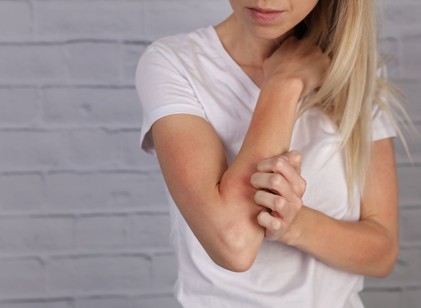 Már véresre vakarta magát a fiatal nő, akinél először ekcémát diagnosztizáltak – a viszketés végül daganatot jelzett című cikk nyitóképe