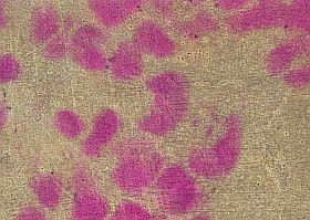 Egy halálos kór - a téli szezonban?