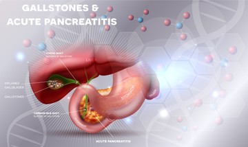 Epekő: oka, kialakulása, tünete és kezelési lehetőségei