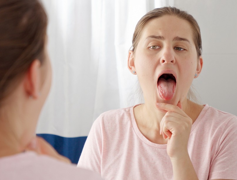 lepedék dudor nyelv száj oka