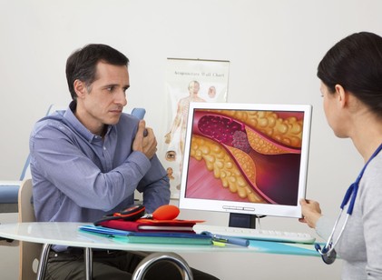 Sokan nem veszik komolyan: ezek a jelek árulkodhatnak arról, hogy az artériái beszűkültek című cikk nyitóképe