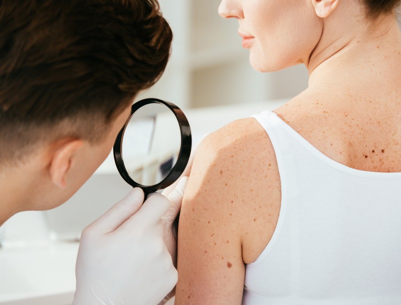 melanóma bőrrák típus tünet